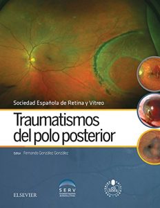 Baixar Traumatismos del polo posterior pdf, epub, eBook
