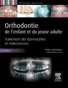 Baixar Orthodontie de l’enfant et du jeune adulte -Tome 2: Traitements des dysmorphies et malocclusions pdf, epub, eBook