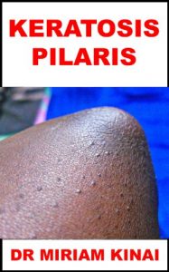 Baixar Dermatology: Keratosis Pilaris (Skin Diseases Book 41) (English Edition) pdf, epub, eBook