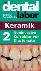Baixar Noninvasive Korrektur von Diastemata (das dental labor Fachtexte 8) (German Edition) pdf, epub, eBook