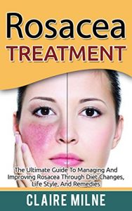 Baixar Rosacea Treatment: The Ultimate Guide To Managing And Improving Rosacea Through Diet Changes, Lifestyle, And Remedies (English Edition) pdf, epub, eBook