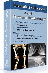 Baixar Essentials of Orthopedic and Trauma Radiology – Basics of Orthopaedic X-Rays (English Edition) pdf, epub, eBook