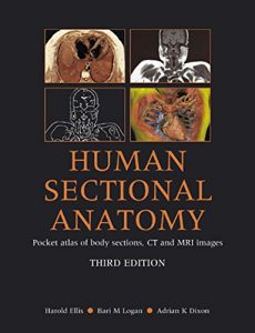 Baixar Human Sectional Anatomy: Pocket Atlas of Body Sections, CT and MRI Images, Third Edition pdf, epub, eBook