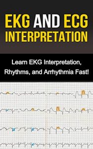Baixar EKG and ECG Interpretation: Learn EKG Interpretation, Rhythms, and Arrhythmia Fast! (English Edition) pdf, epub, eBook
