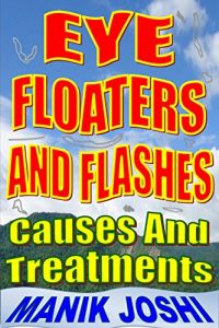 Baixar Eye Floaters and Flashes: Causes and Treatments (English Edition) pdf, epub, eBook