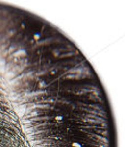 Baixar Caspa pdf, epub, eBook