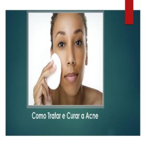 Baixar Como Se Livrar das Espinhas pdf, epub, eBook