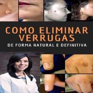 Baixar Como Eliminar Verrugas de Forma Natural e Definitiva pdf, epub, eBook
